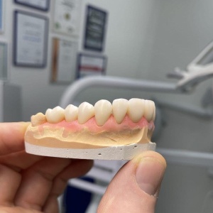 Фото от владельца АнтАлекс, зуботехническая лаборатория