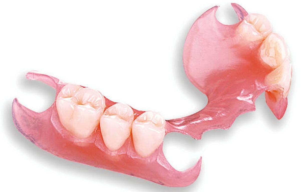 мягкие зубные протезы фото